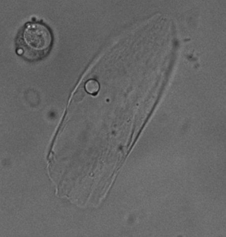 A picture of a lamellocyte cell under a microscope. The cell looks amoeba-like and gelatinous. 